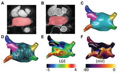 In silico Comparison of Left Atrial Ablation Techniques That Target the Anatomical, Structural, and Electrical Substrates of Atrial Fibrillation